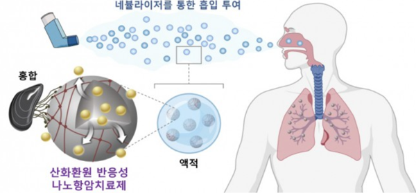포스텍 연구팀이 개발한 흡입형 점막 접착성 나노항암치료제 모식도. 사진=포스텍