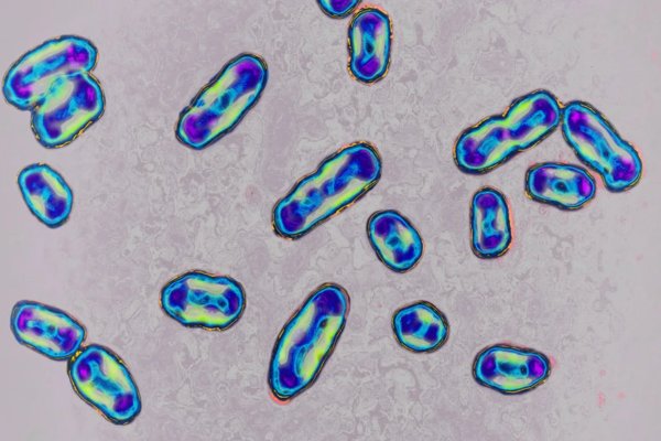 현미경으로 관찰된 페스트균(Yersinia pestis)은 흑사병을 일으키는 세균이다.